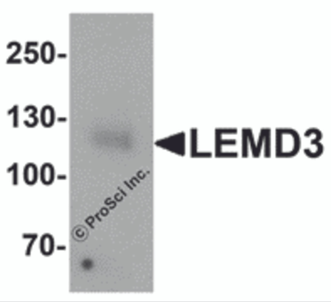 Western blot analysis of LEMD3 in human colon tissue lysate with LEMD3 antibody at 1 &#956;g/mL.