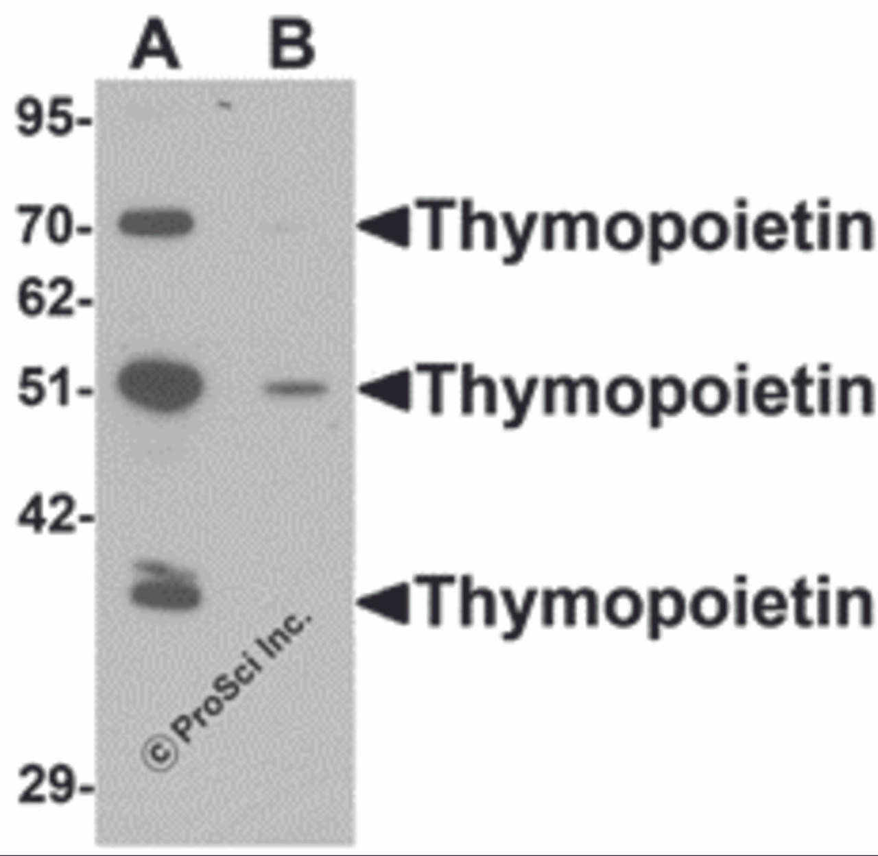 Western blot analysis of Thymopoietin in HeLa cell lysate with Thymopoietin antibody at 0.25 &#956;g/mLl in (A) the absence and (B) the presence of blocking peptide.