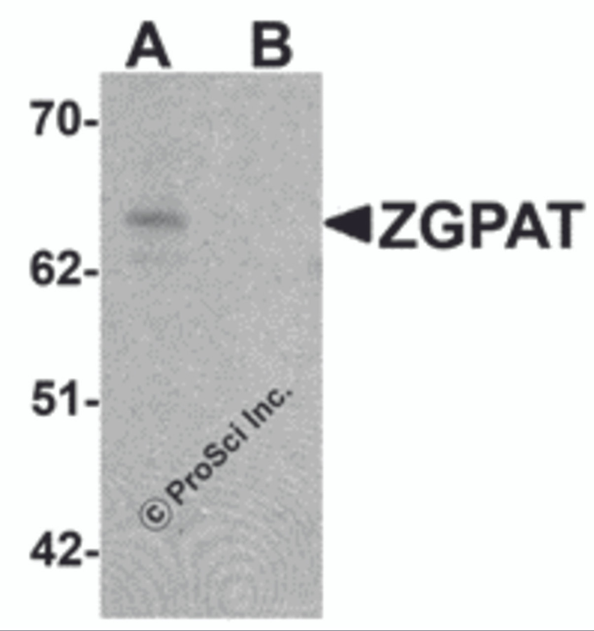 Western blot analysis of ZGPAT in SK-N-SH cell lysate with ZGPAT antibody at 1 &#956;g/mL in (A) the absence and (B) the presence of blocking peptide.