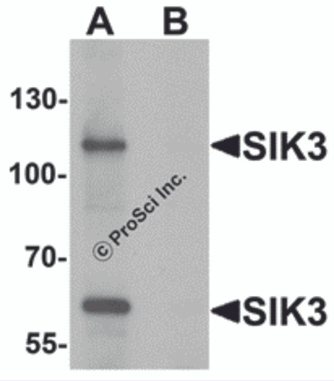 Western blot analysis of SIK3 in rat brain tissue lysate with SIK3 antibody at 1 &#956;g/mL in (A) the absence and (B) the presence of blocking peptide.