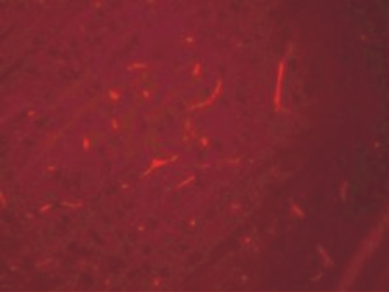 Immunofluorescence of SIK3 in rat brain cells with SIK3 antibody at 20 ug/mL.
