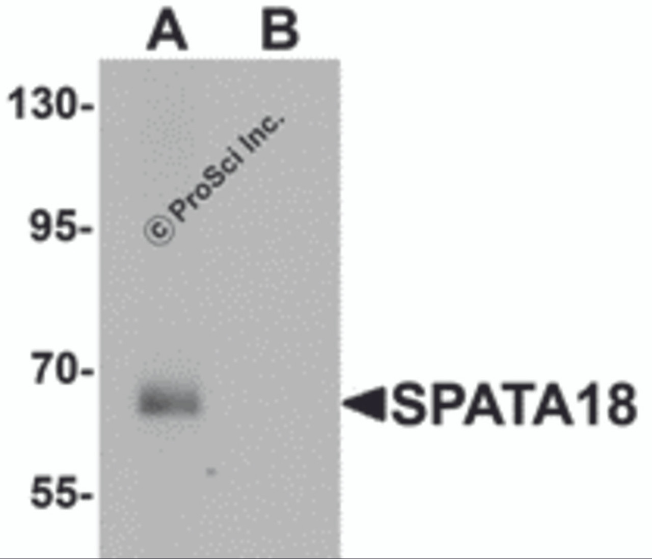 Western blot analysis of SPATA18 in rat lung tissue lysate with SPATA18 antibody at 1 &#956;g/mL in (A) the absence and (B) the presence of blocking peptide
