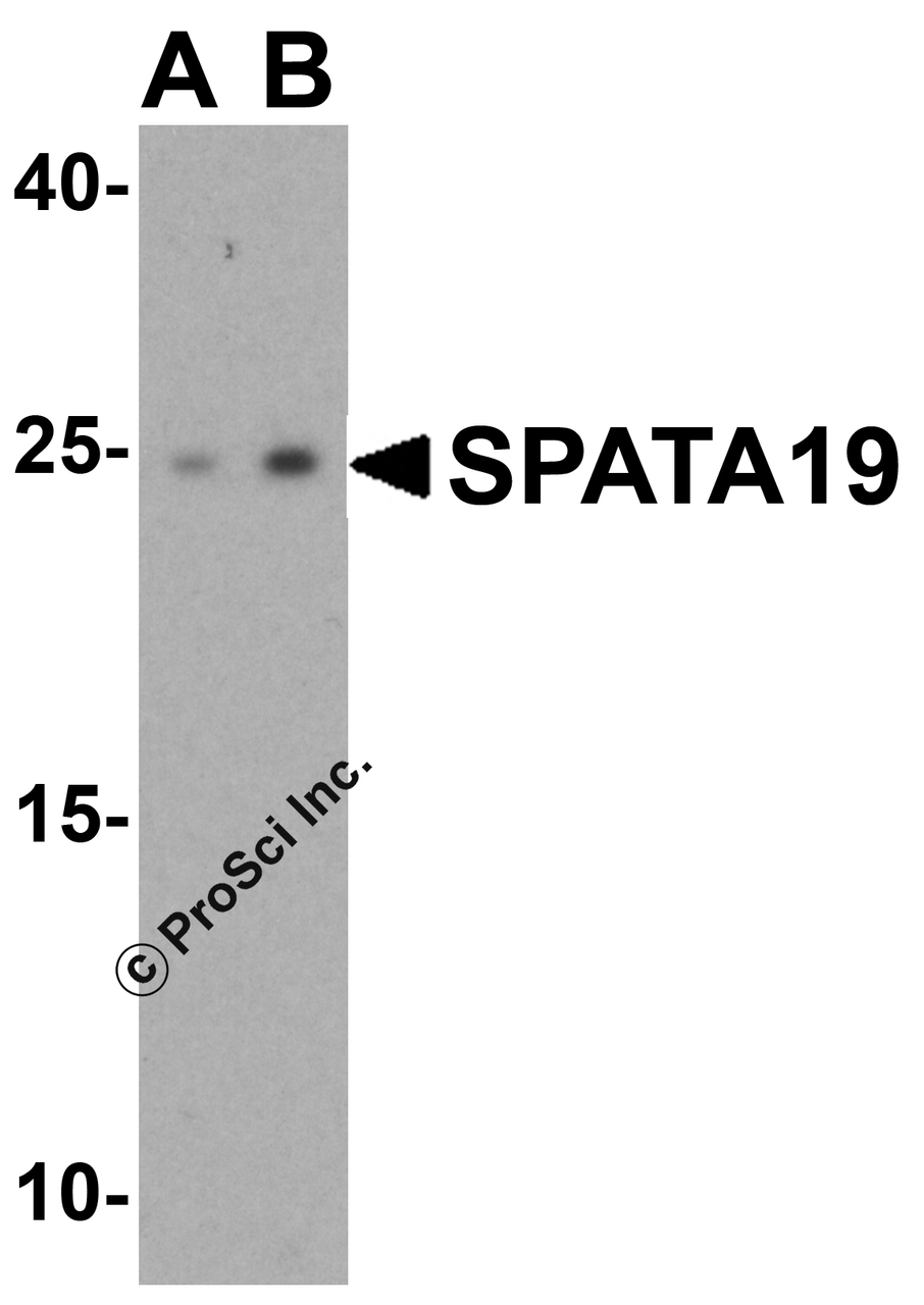 Western blot analysis of SPATA19 in human testis tissue lysate with SPATA19 antibody at (A) 1 and (B) 2 &#956;g/mL.