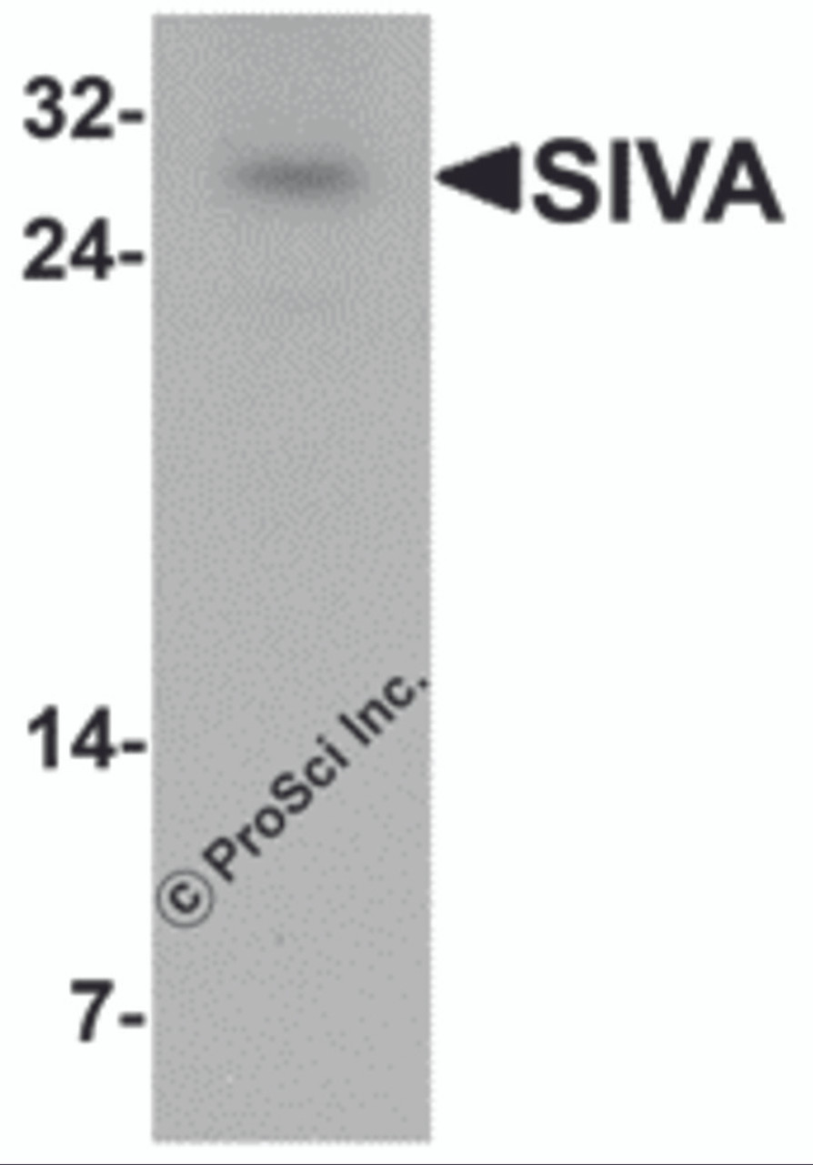 Western blot analysis of SIVA in mouse liver tissue lysate with SIVA antibody at 1 &#956;g/mL.