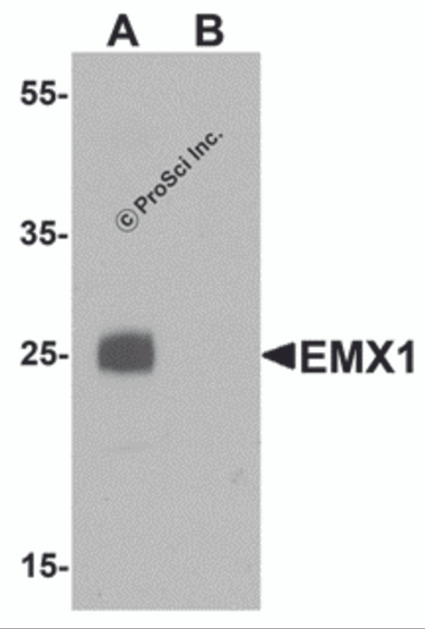 Western blot analysis of EMX1 in rat liver tissue lysate with EMX1 antibody at 1 &#956;g/mL in (A) the absence and (B) the presence of blocking peptide.