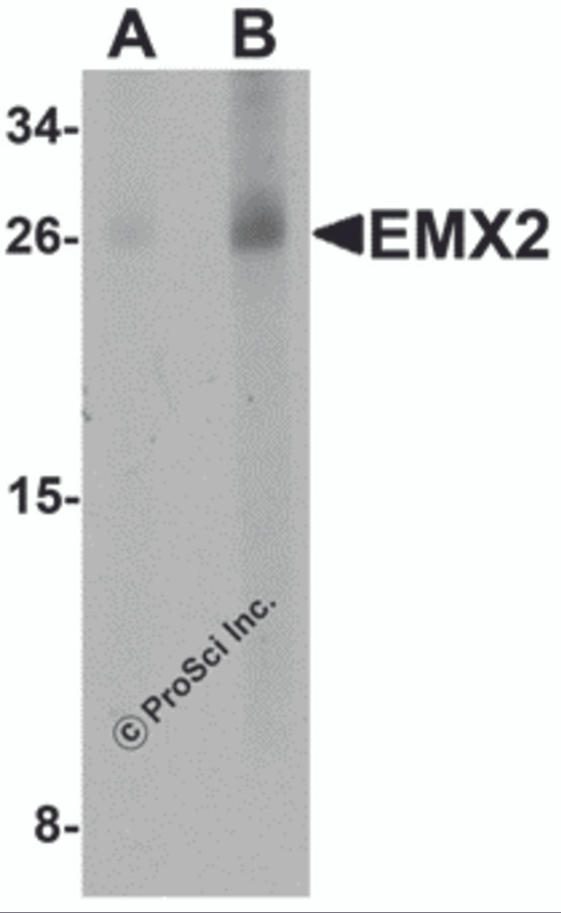 Western blot analysis of EMX2 in human lung tissue lysate with EMX2 antibody at (A) 1 and (B) 2 &#956;g/mL.