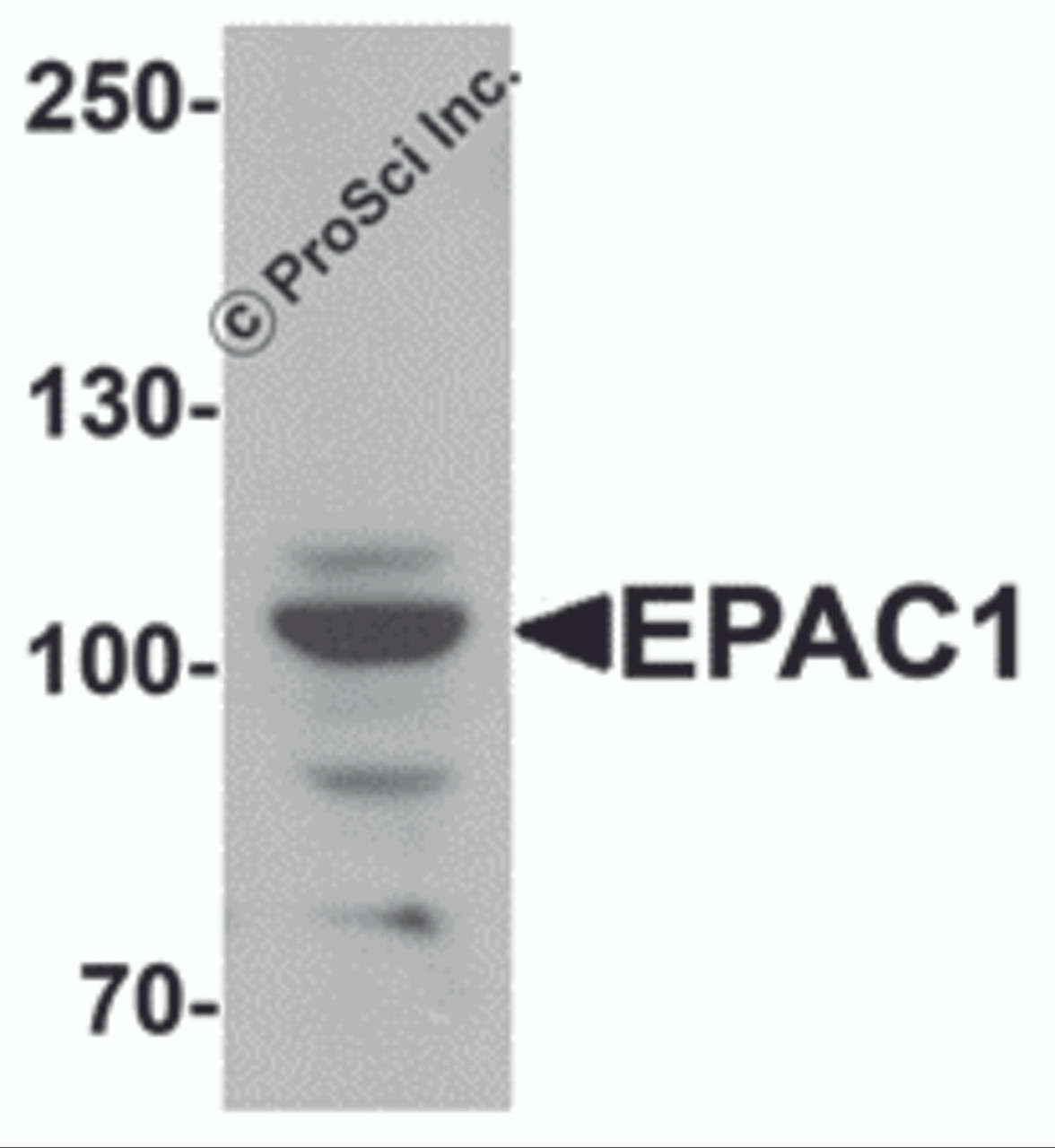 Western blot analysis of EPAC1 in rat skeletal muscle tissue lysate with EPAC1 antibody at 1 &#956;g/mL.