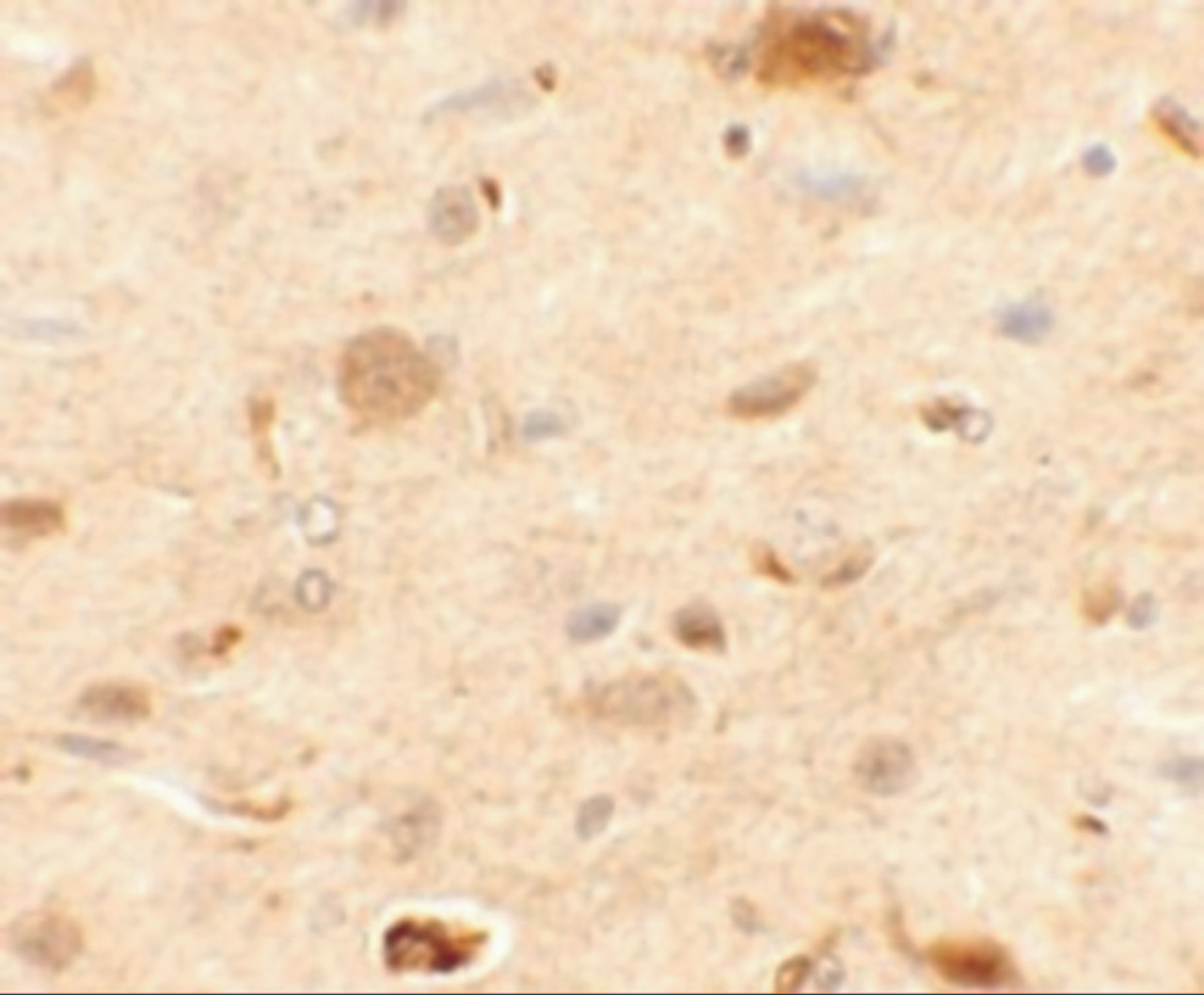 Immunohistochemistry of EPAC1 in rat brain tissue with EPAC1 antibody at 2.5 ug/mL.