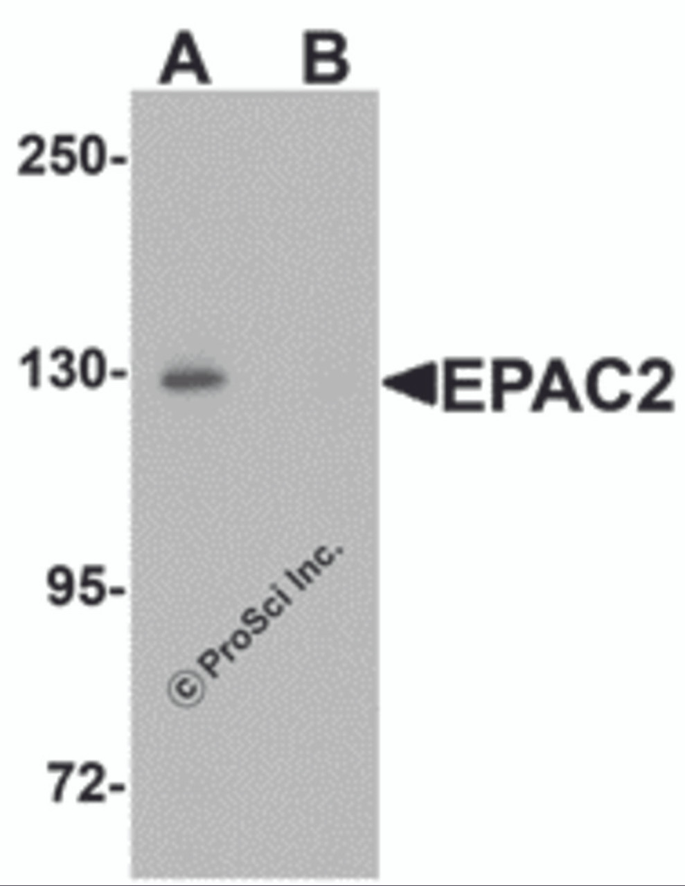 Western blot analysis of EPAC2 in rat liver tissue lysate with EPAC2 antibody at 1 &#956;g/mL in (A) the absence and (B) the presence of blocking peptide.