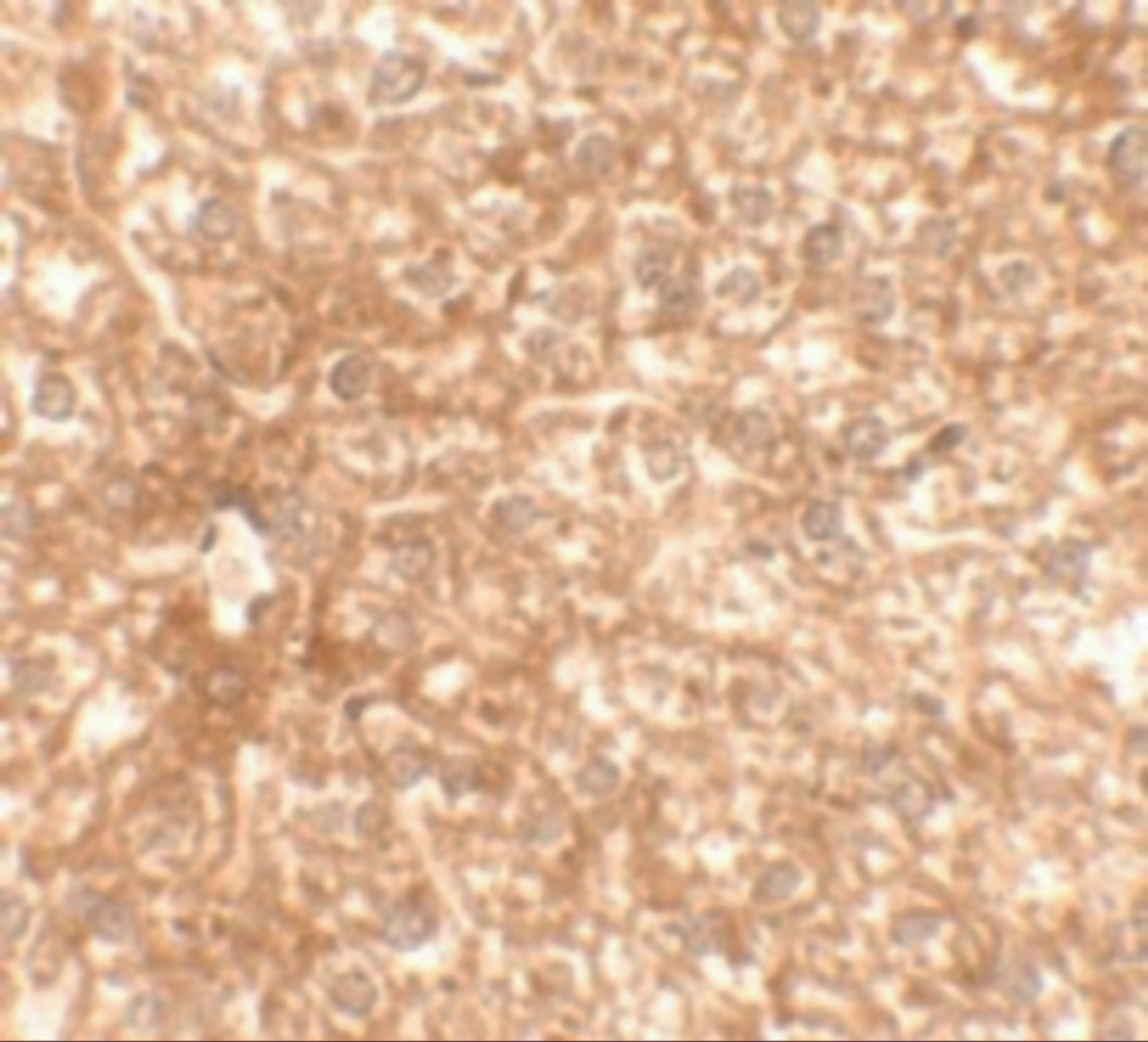 Immunohistochemistry of EPAC3 in mouse liver tissue with EPAC3 antibody at 2.5 ug/mL.