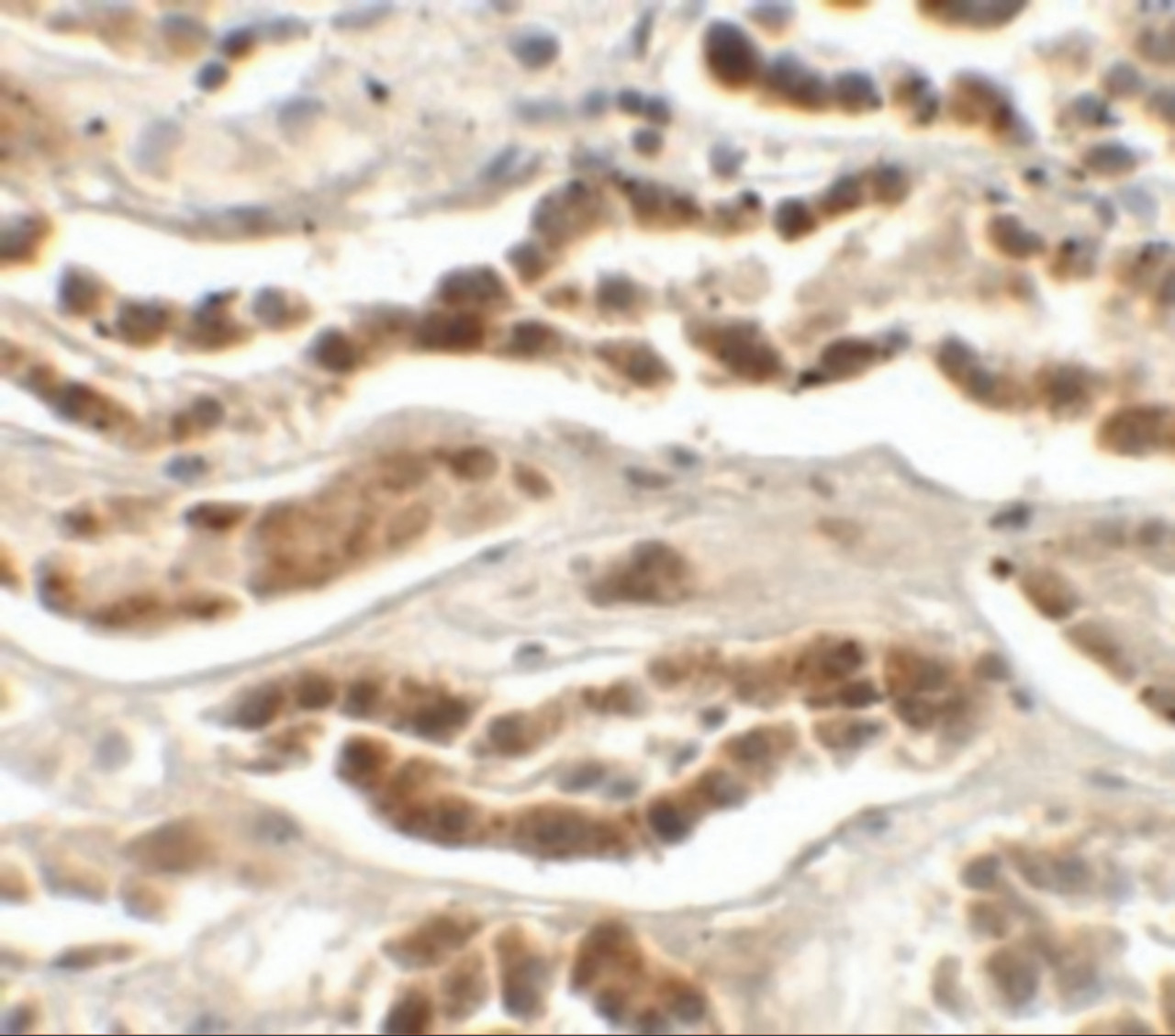 Immunohistochemistry of LZTS2 in human kidney tissue with LZTS2 antibody at 2.5 ug/mL.