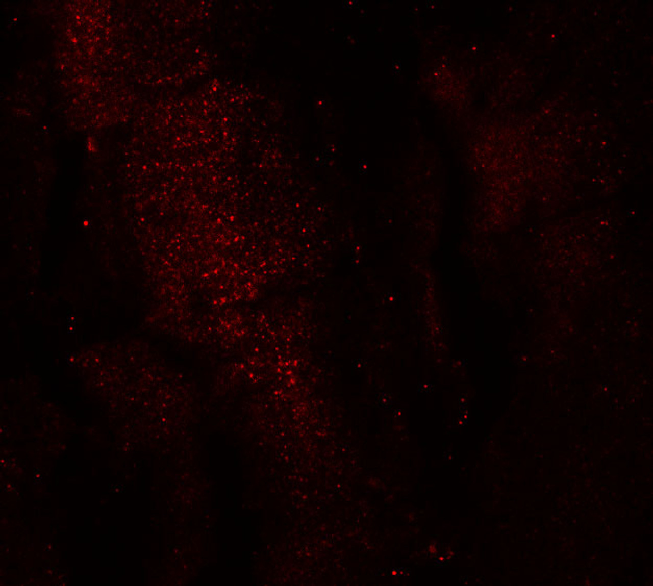 Immunofluorescence of RKHD3 in mouse skeletal muscle cells with RKHD3 antibody at 20 ug/mL.