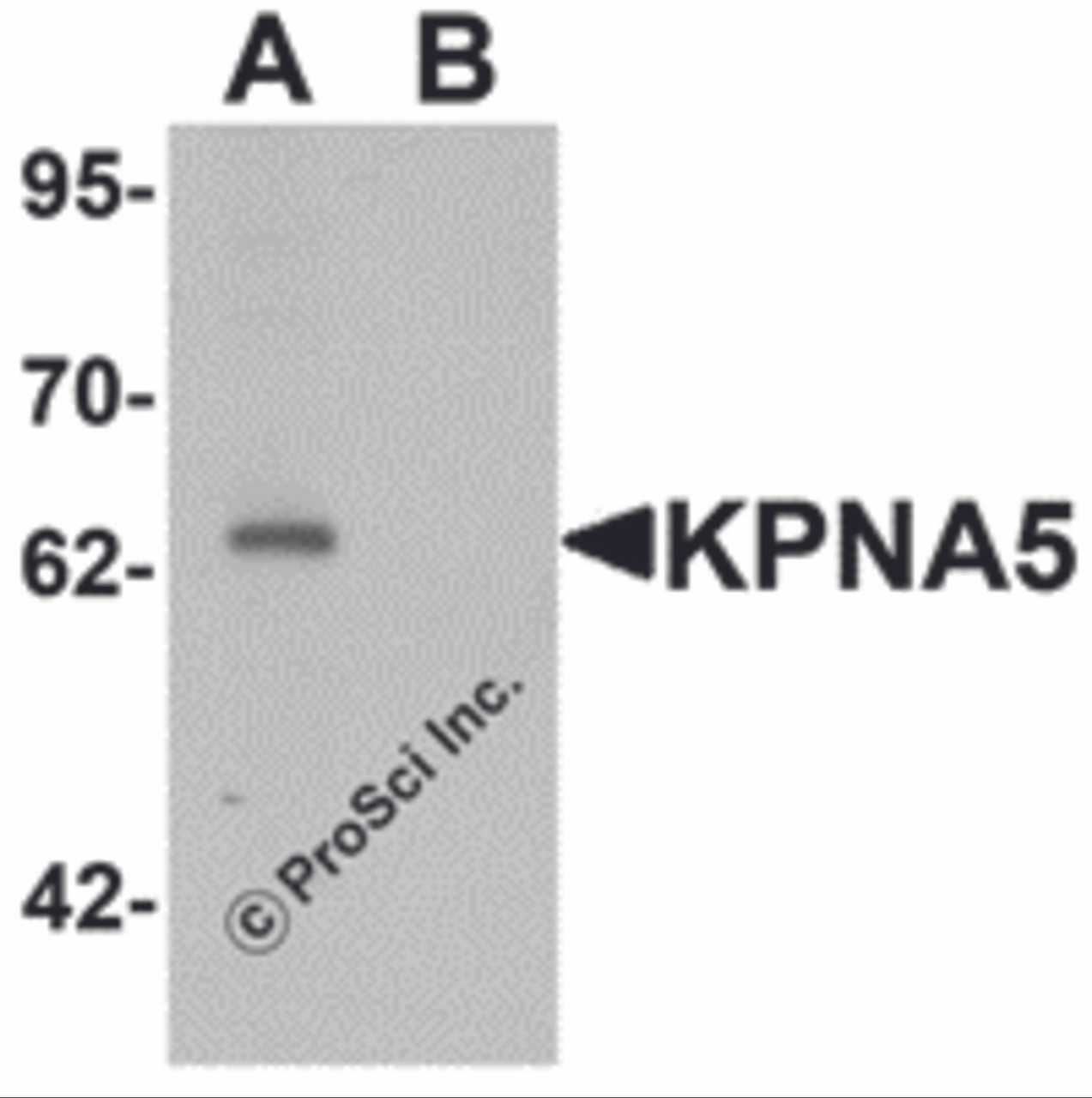 Western blot analysis of KPNA6 in EL4 cell lysate with KPNA5 antibody at 1 &#956;g/mL in (A) the absence and (B) the presence of blocking peptide.