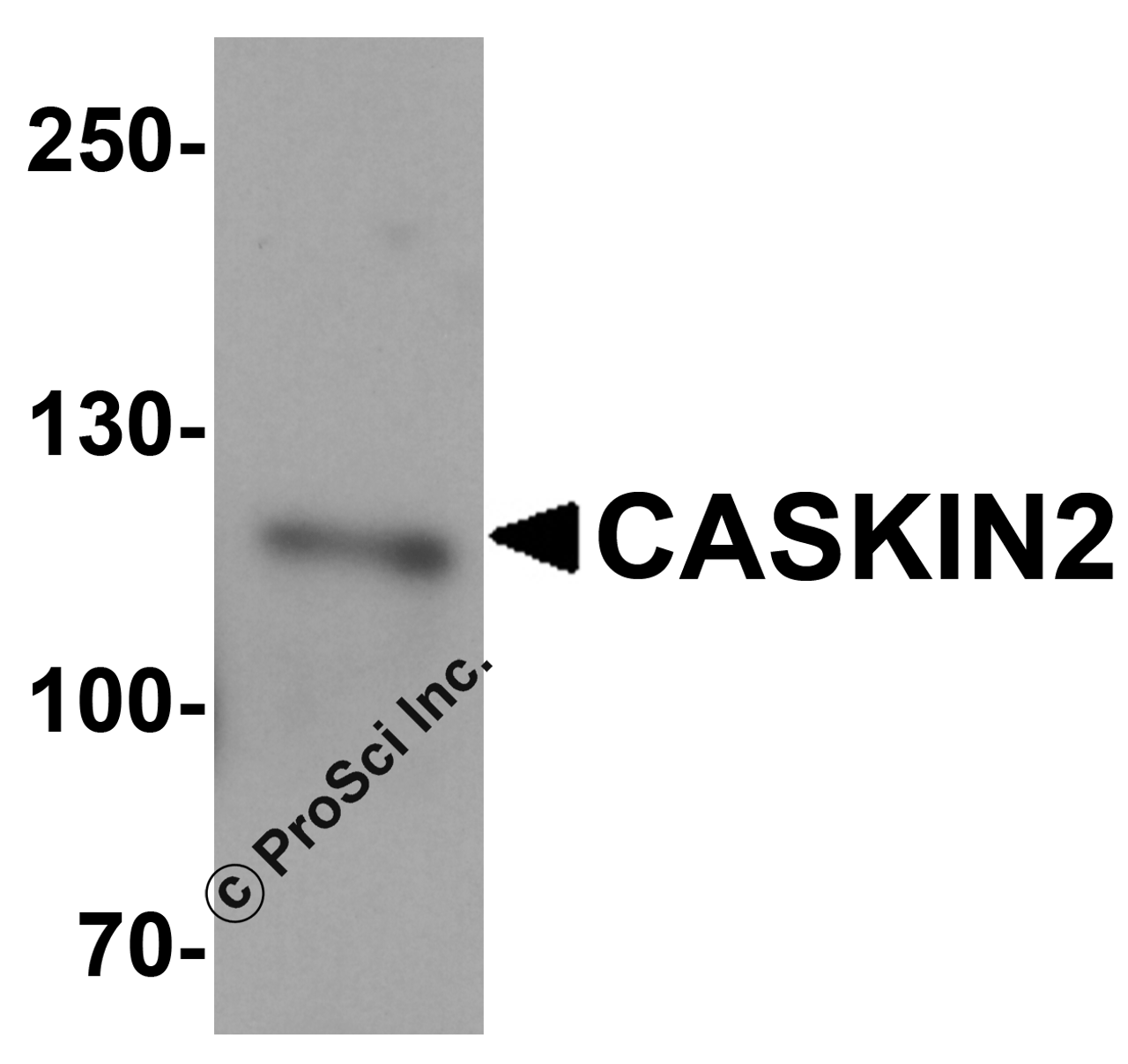 Western blot analysis of CASKIN2 HeLa cell tissue lysate with CASKIN2 antibody at 1 &#956;g/mL.