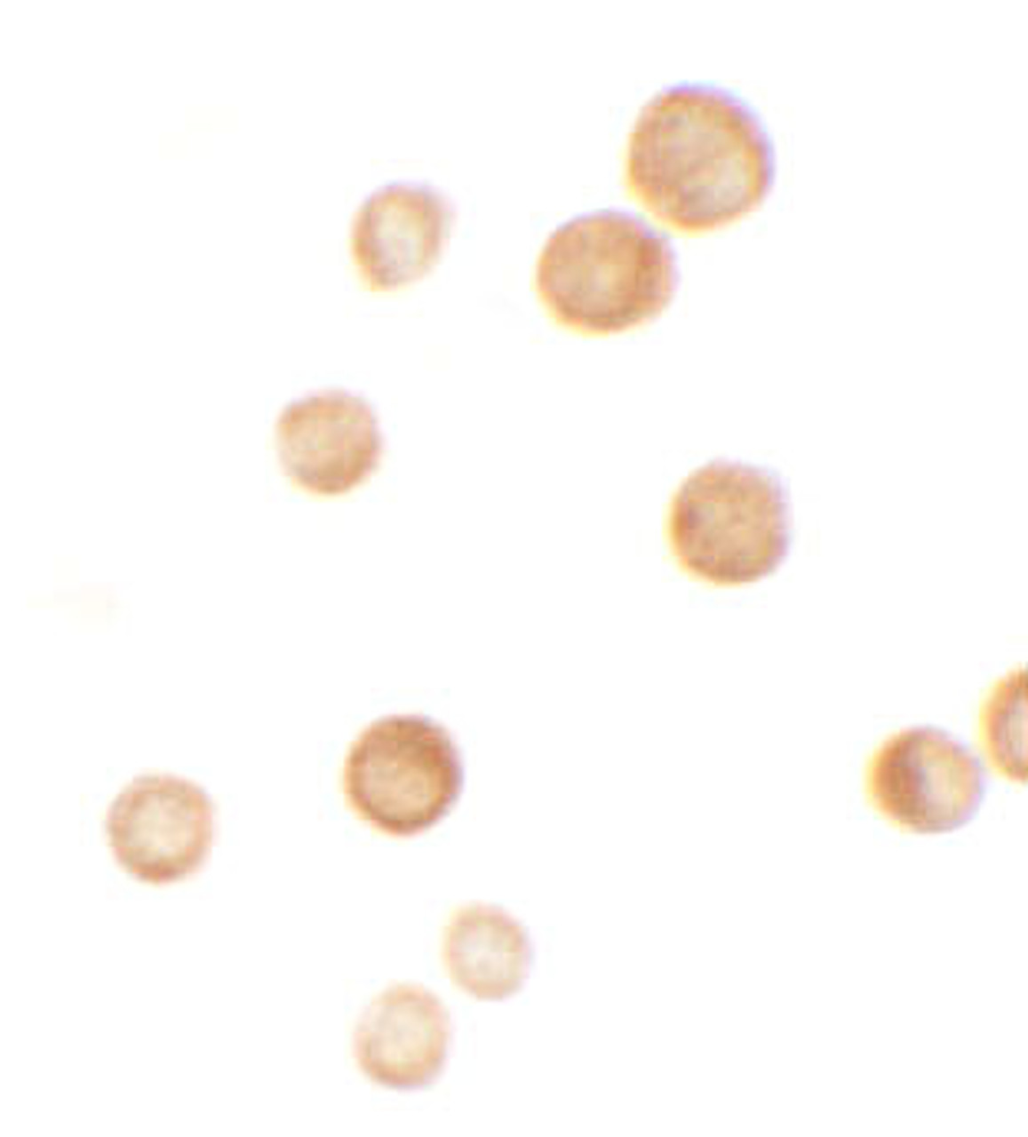 Immunocytochemistry of CASKIN2 in HeLa cells with CASKIN2 antibody at 2.5 ug/mL.