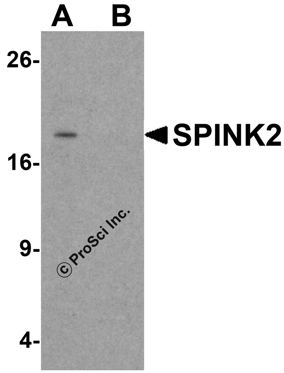 Western blot analysis of SPINK2 in human testis tissue lysate with SPINK2 antibody at 1 &#956;g/mL in (A) the absence and (B) the presence of blocking peptide.