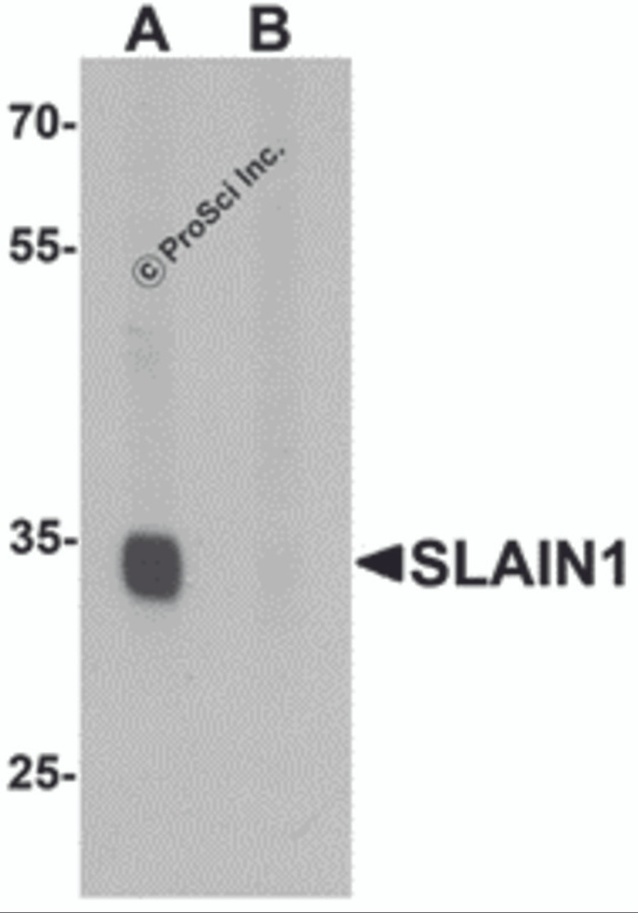 Western blot analysis of SLAIN1 in A549 cell lysate with SLAIN1 antibody at 1 &#956;g/mL in (A) the absence and (B) the presence of blocking peptide.