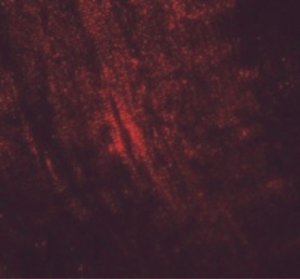 Immunofluorescence of MYBPC1 in mouse skeletal muscle cells with MYBPC1 antibody at 20 ug/mL.