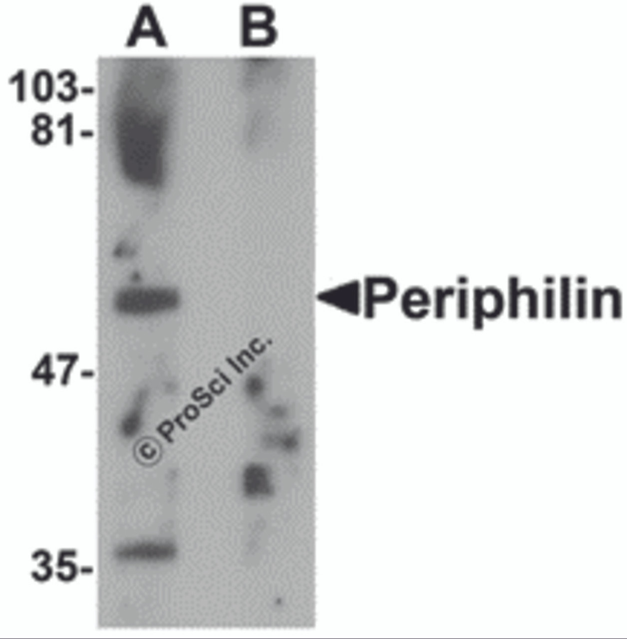 Western blot analysis of Periphilin in mouse colon tissue lysate with Periphilin antibody at 1 &#956;g/mL in (A) the absence and (B) the presence of blocking peptide.