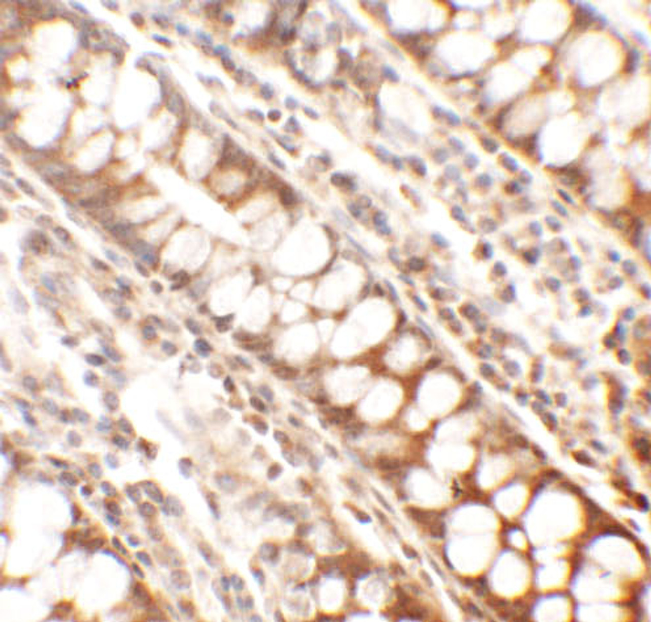 Immunohistochemistry of Periphilin in human colon tissue with Periphilin antibody at 2.5 ug/mL.