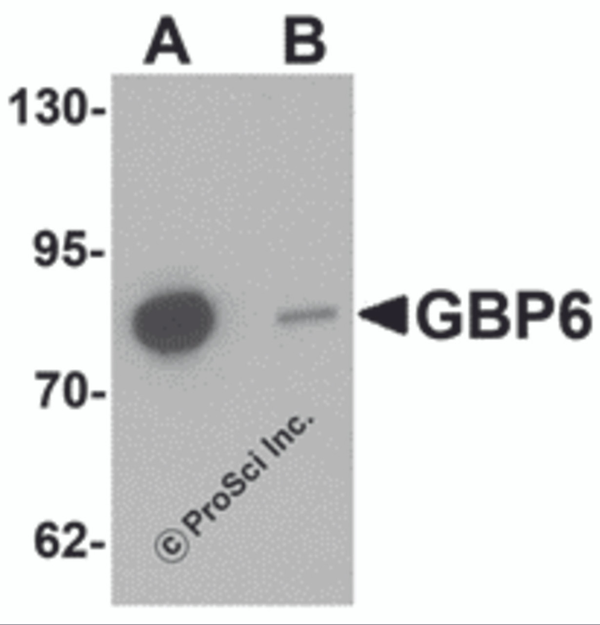 Western blot analysis of GBP6 in Hela cell lysate with GBP6 antibody at 0.5 &#956;g/mL in (A) the absence and (B) the presence of blocking peptide.