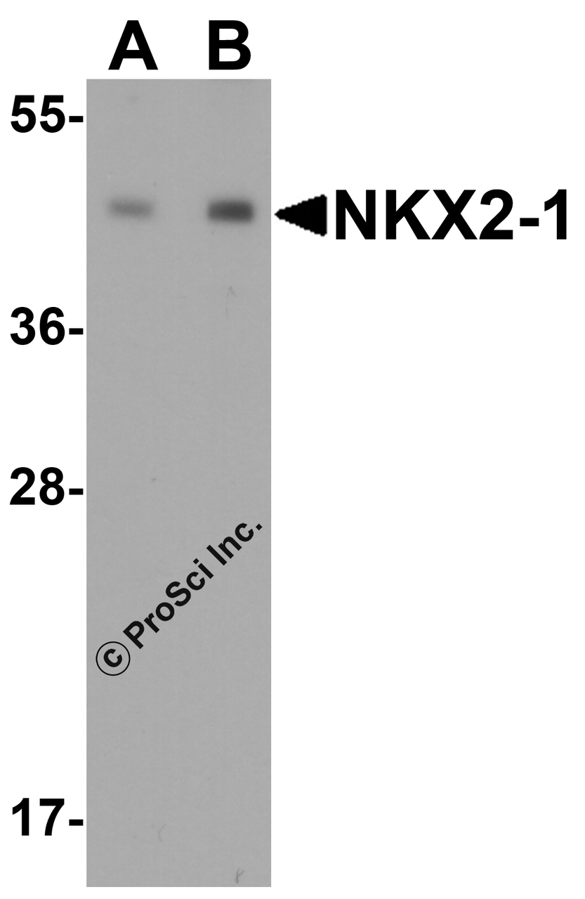 Western blot analysis of NKX2-1 expression in human lung tissue lysate with NKX2-1 antibody at (A) 0.25 and (B) 0.5 &#956;g/ml.