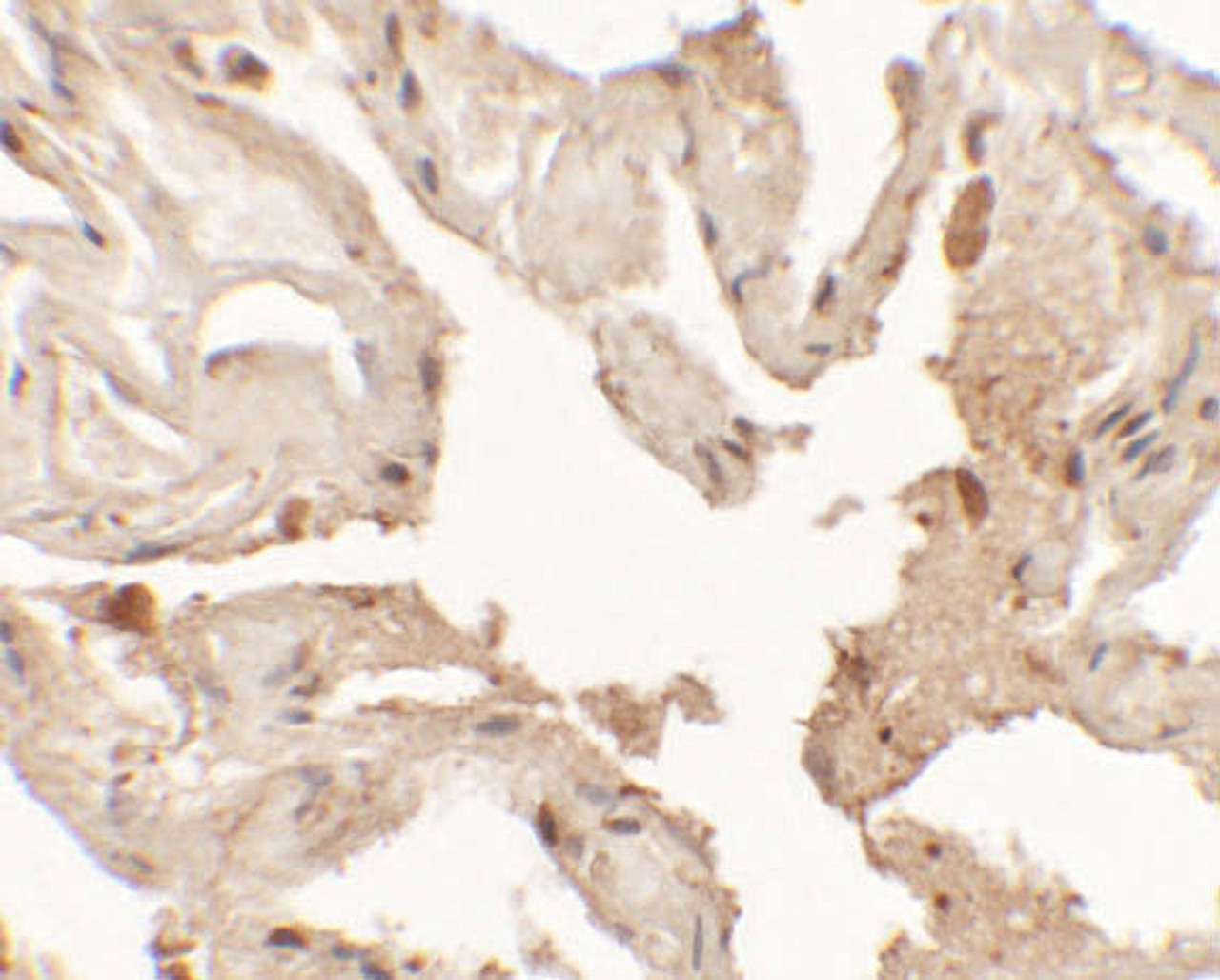 Immunohistochemistry of NKX2-1 in human lung tissue with NKX2-1 antibody at 2.5 ug/mL.