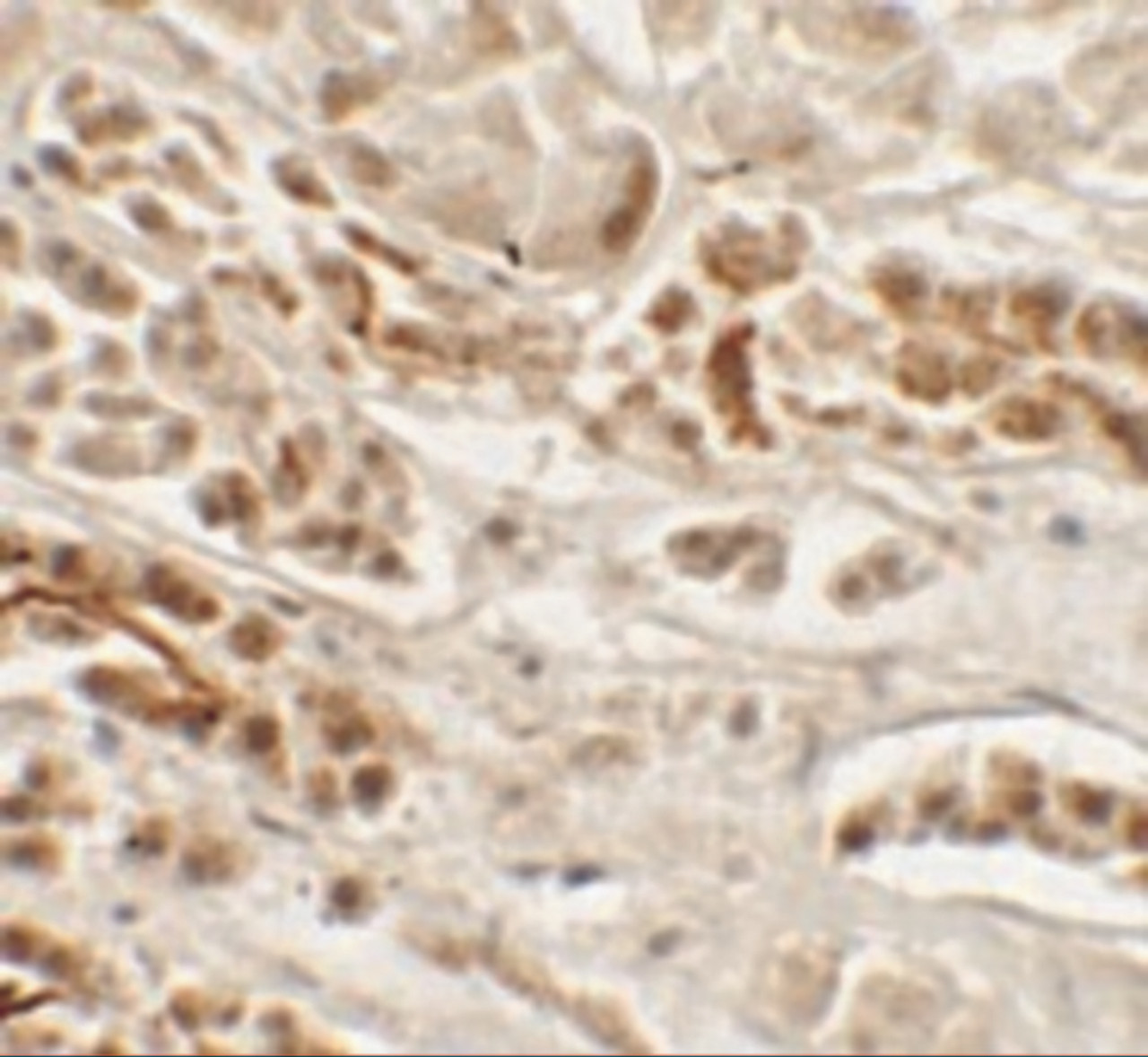 Immunohistochemistry of NKX2-2 in human kidney tissue with NKX2-2 antibody at 2.5 ug/mL.