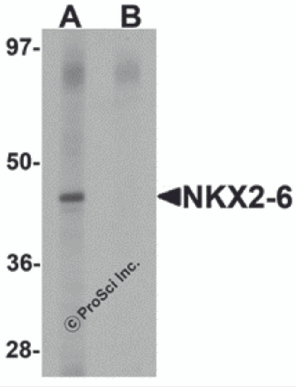 Western blot analysis of NKX2-6 in mouse heart tissue lysate with NKX2-6 antibody at 1 &#956;g/mL in (A) the absence and (B) the presence of blocking peptide.
