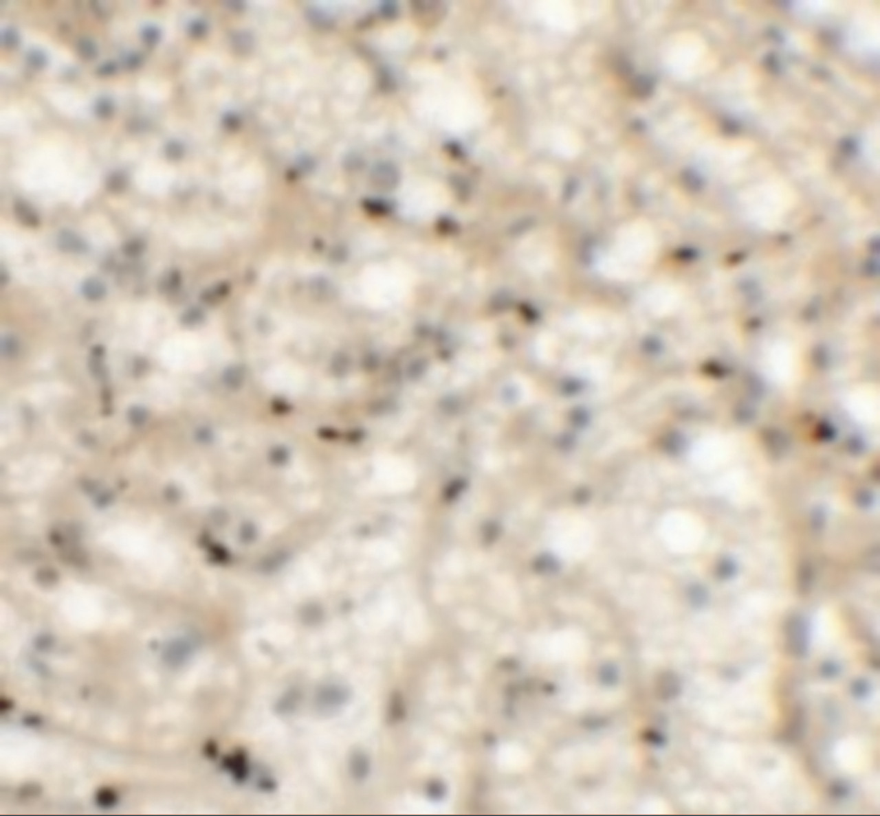Immunohistochemistry of NKX2-6 in human spleen tissue with NKX2-6 antibody at 5 ug/mL.