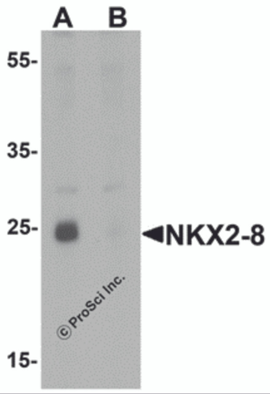 Western blot analysis of NKX2-8 in rat liver tissue lysate with NKX2-8 antibody at 1 &#956;g/mL in (A) the absence and (B) the presence of blocking peptide