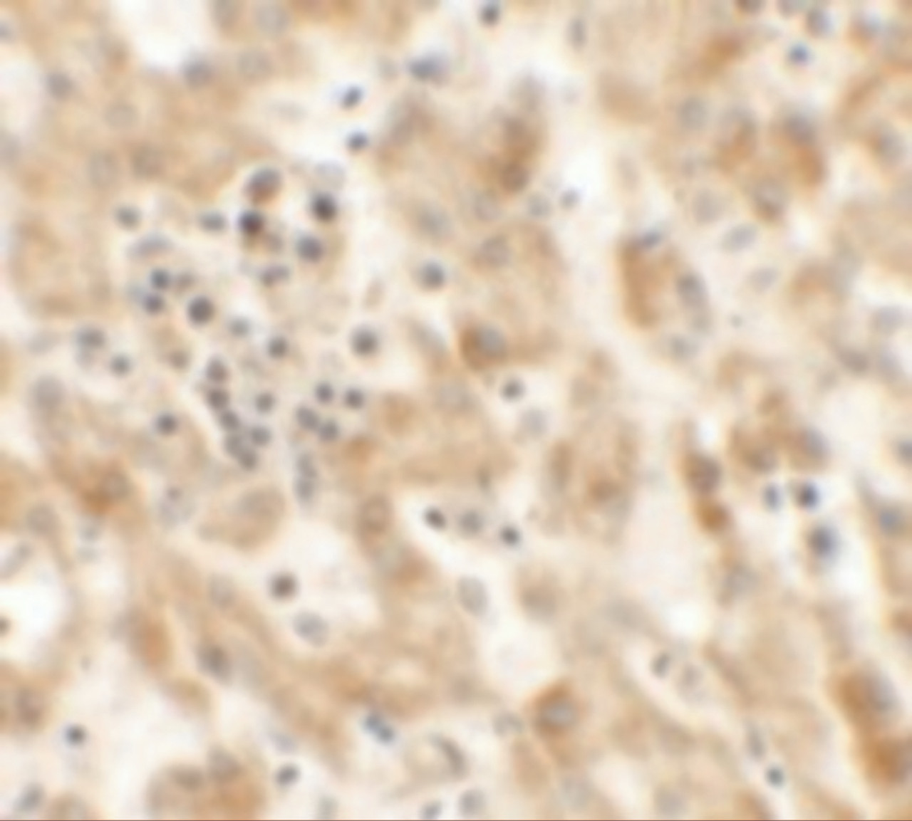Immunohistochemistry of NKX2-8 in human liver tissue with NKX2-8 antibody at 2.5 ug/mL.