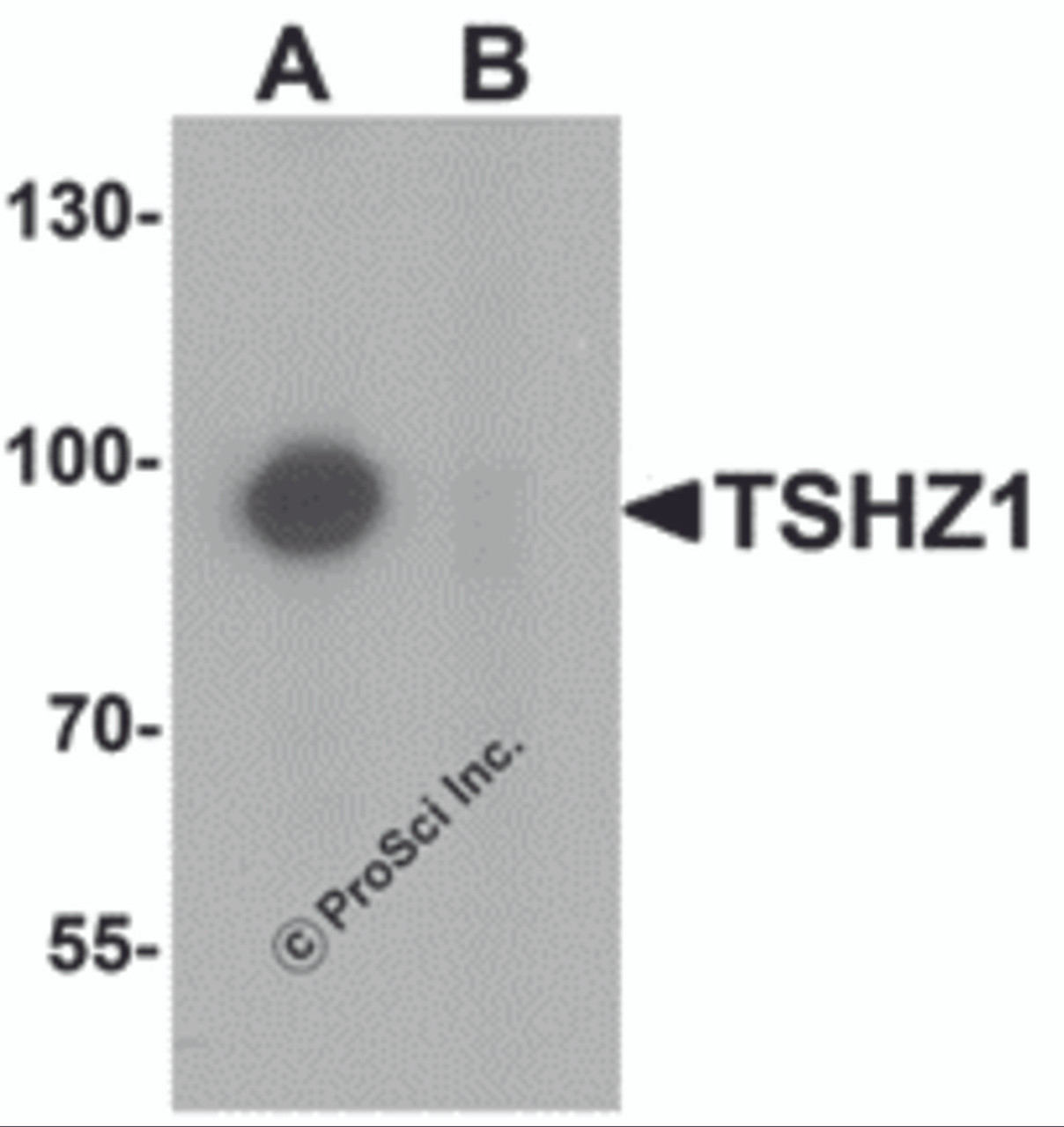 Western blot analysis of TSHZ1 in A-20 cell lysate with TSHZ1 antibody at 1 &#956;g/mL in (A) the absence and (B) the presence of blocking peptide.