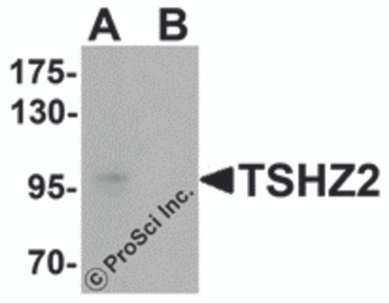 Western blot analysis of TSHZ2 in A-20 cell lysate with TSHZ2 antibody at 1 &#956;g/mL in (A) the absence and (B) the presence of blocking peptide.