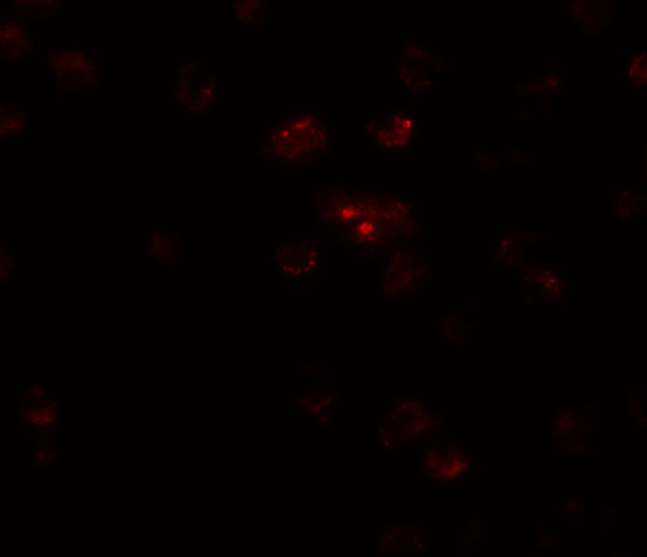 Immunofluorescence of TSHZ2 in A20 cells with TSHZ2 antibody at 20 ug/mL.