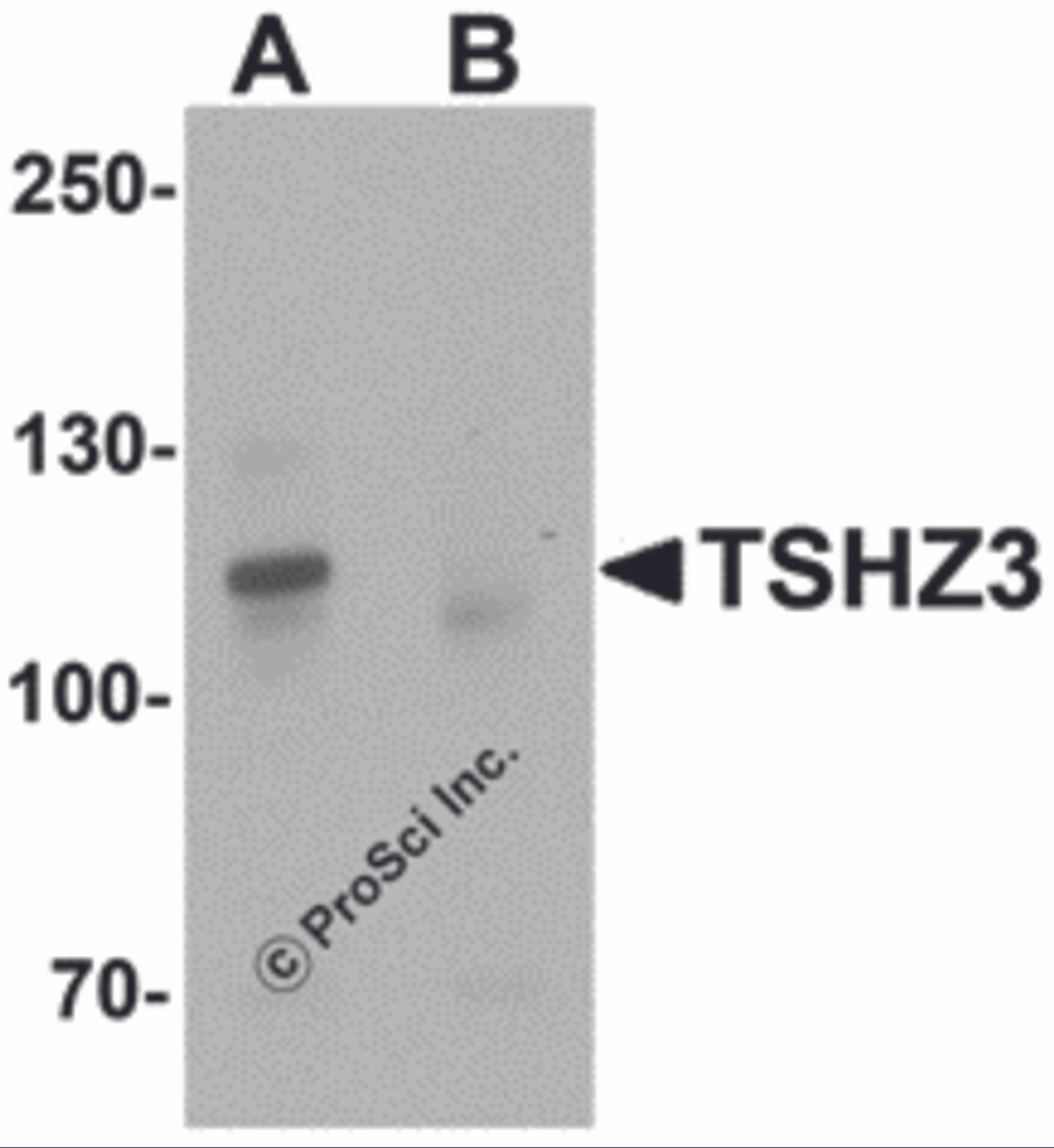 Western blot analysis of TSHZ3 in mouse brain tissue lysate with TSHZ3 antibody at 1 &#956;g/mL in (A) the absence and (B) the presence of blocking peptide.