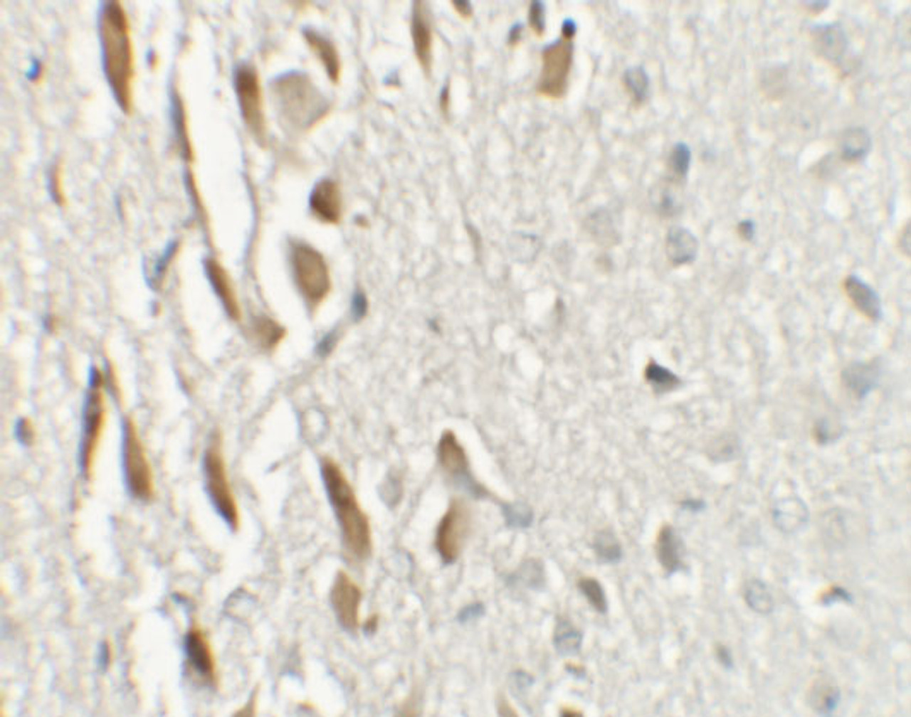 Immunohistochemistry of TSHZ3 in mouse brain tissue with TSHZ3 antibody at 2.5 ug/mL.