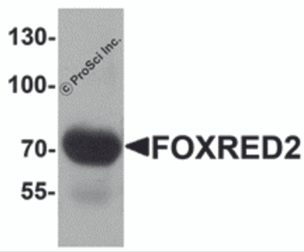 Western blot analysis of FOXRED2 in human lung tissue lysate with FOXRED2 antibody at 1 &#956;g/mL.