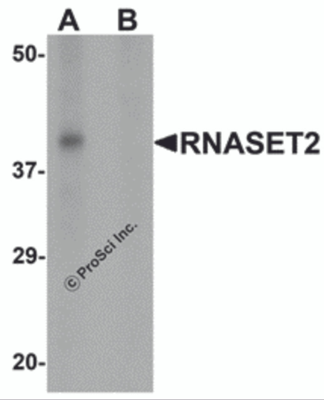 Western blot analysis of RNASET2 in SW480 cell lysate with RNASET2 antibody at 1 &#956;g/mL in (A) the absence and (B) the presence of blocking peptide.