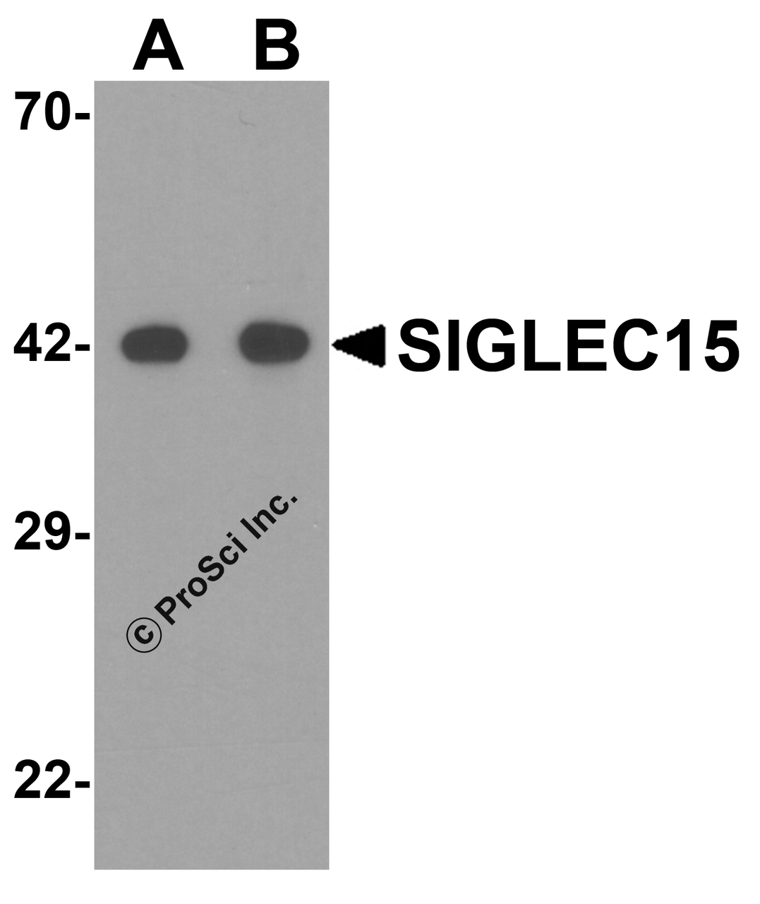 Western blot analysis of SIGLEC15 in human kidney tissue lysate with SIGLEC15 antibody at (A) 1 and (B) 2 &#956;g/mL.