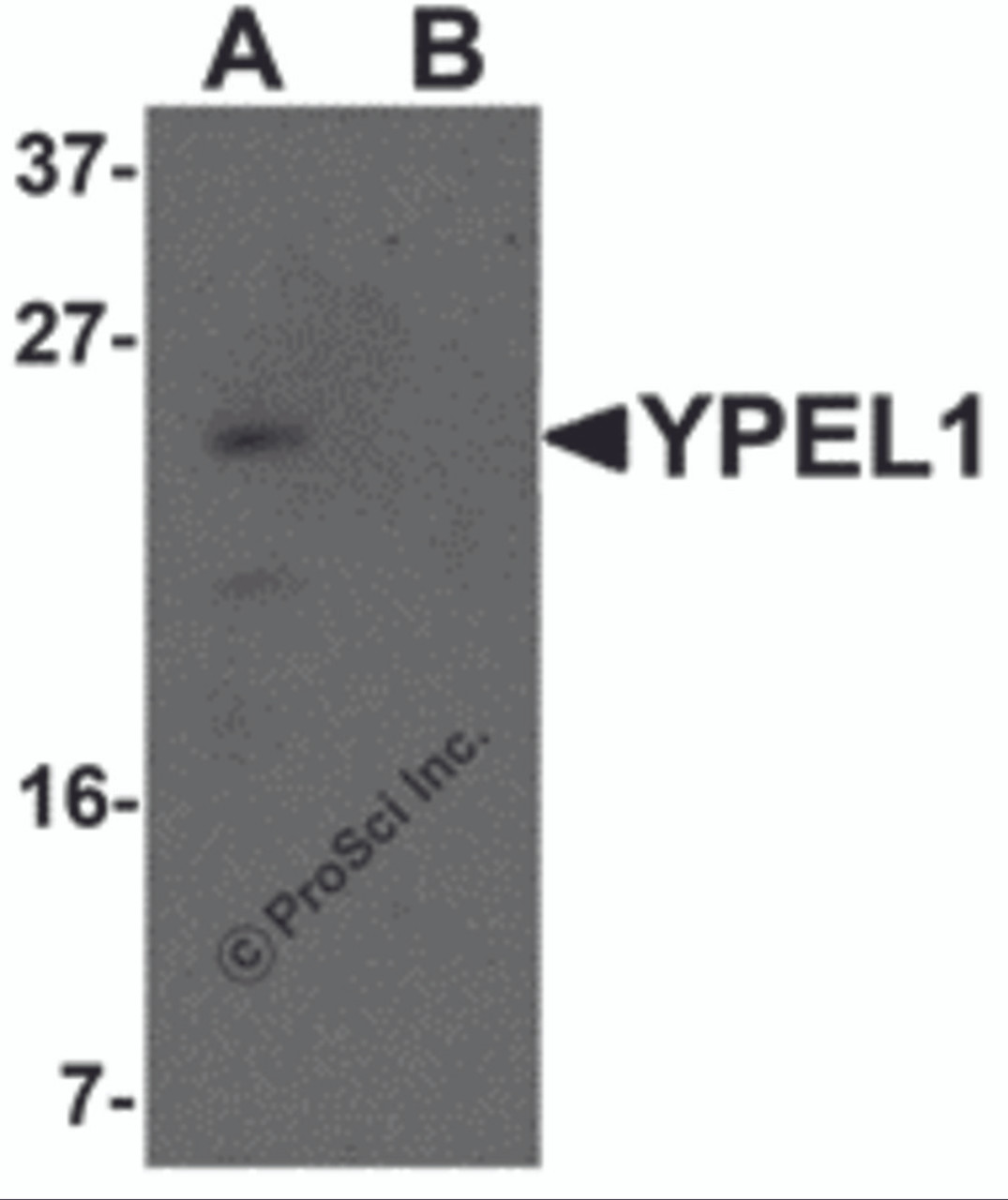 Western blot analysis of YPEL1 in Hela cell lysate with YPEL1 antibody at 1 &#956;g/mL in (A) the absence and (B) the presence of blocking peptide.