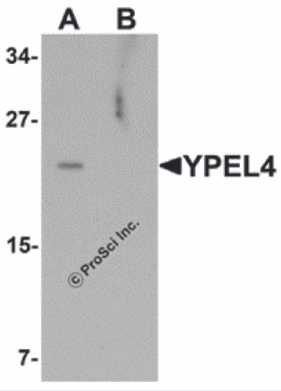 Western blot analysis of YPEL4 in SW480 cell lysate with YPEL4 antibody at 1 &#956;g/mL in (A) the absence and (B) the presence of blocking peptide.