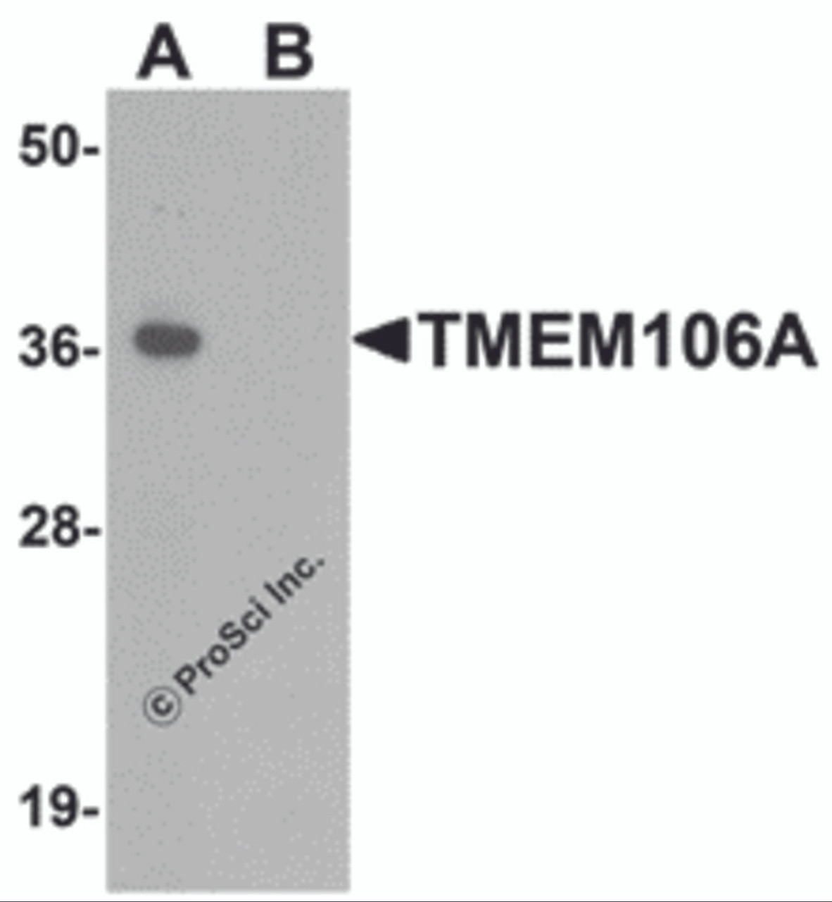 Western blot analysis of TMEM106A in A-20 cell lysate with TMEM106A antibody at 1 &#956;g/mL in (A) the absence and (B) the presence of blocking peptide.