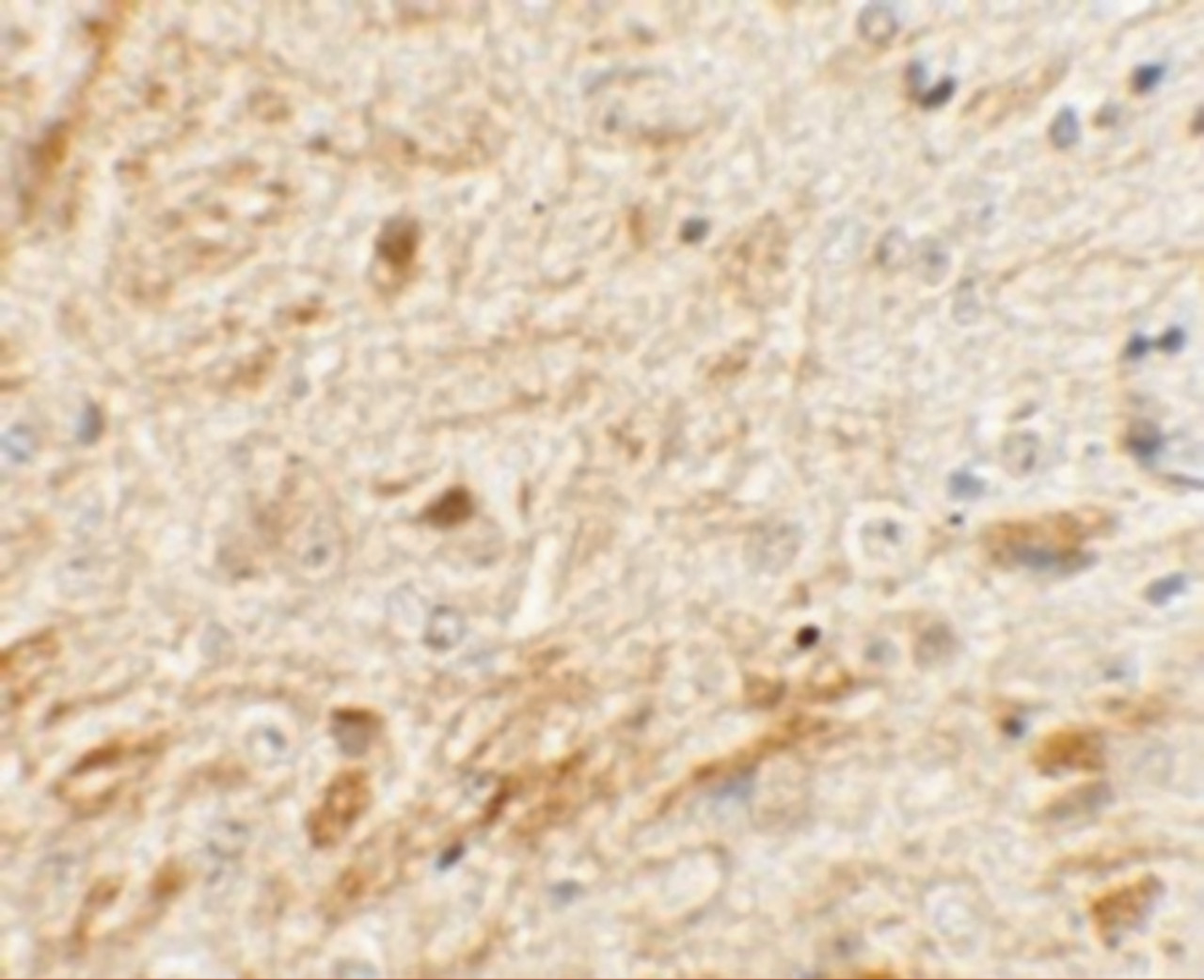Immunohistochemistry of TMEM106A in mouse brain tissue with TMEM106A antibody at 5 ug/mL.