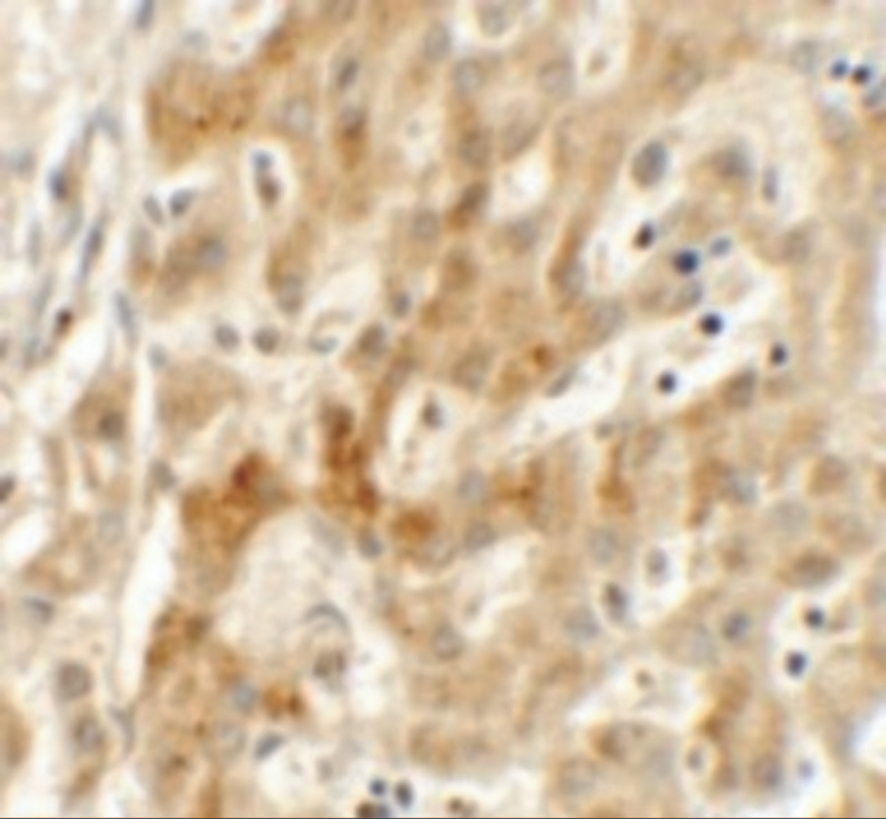 Immunohistochemistry of TMEM106B in human liver tissue with TMEM106B antibody at 2.5 ug/mL.