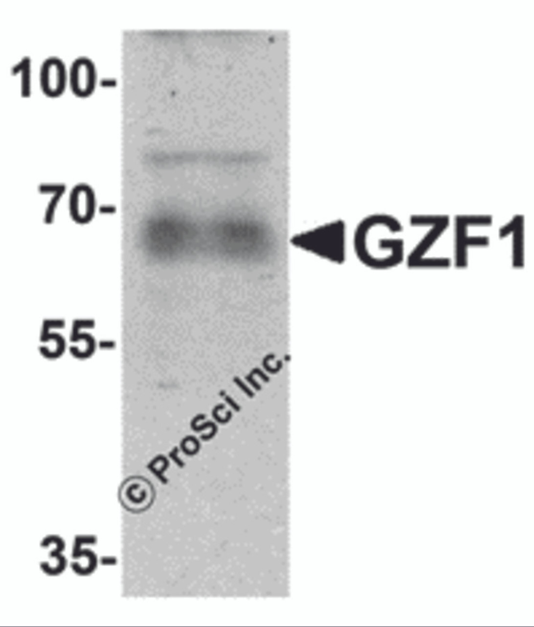 Western blot analysis of GZF1 in human heart tissue lysate with GZF1 antibody at 1 &#956;g/mL.