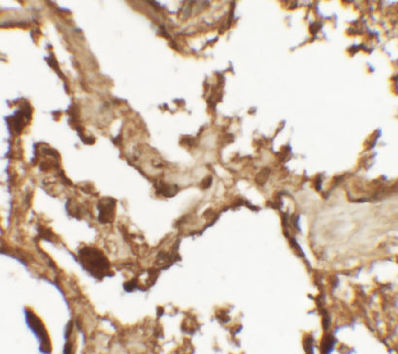 Immunohistochemistry of VKORC1 in human lung tissue with VKORC1 antibody at 2.5 ug/mL.