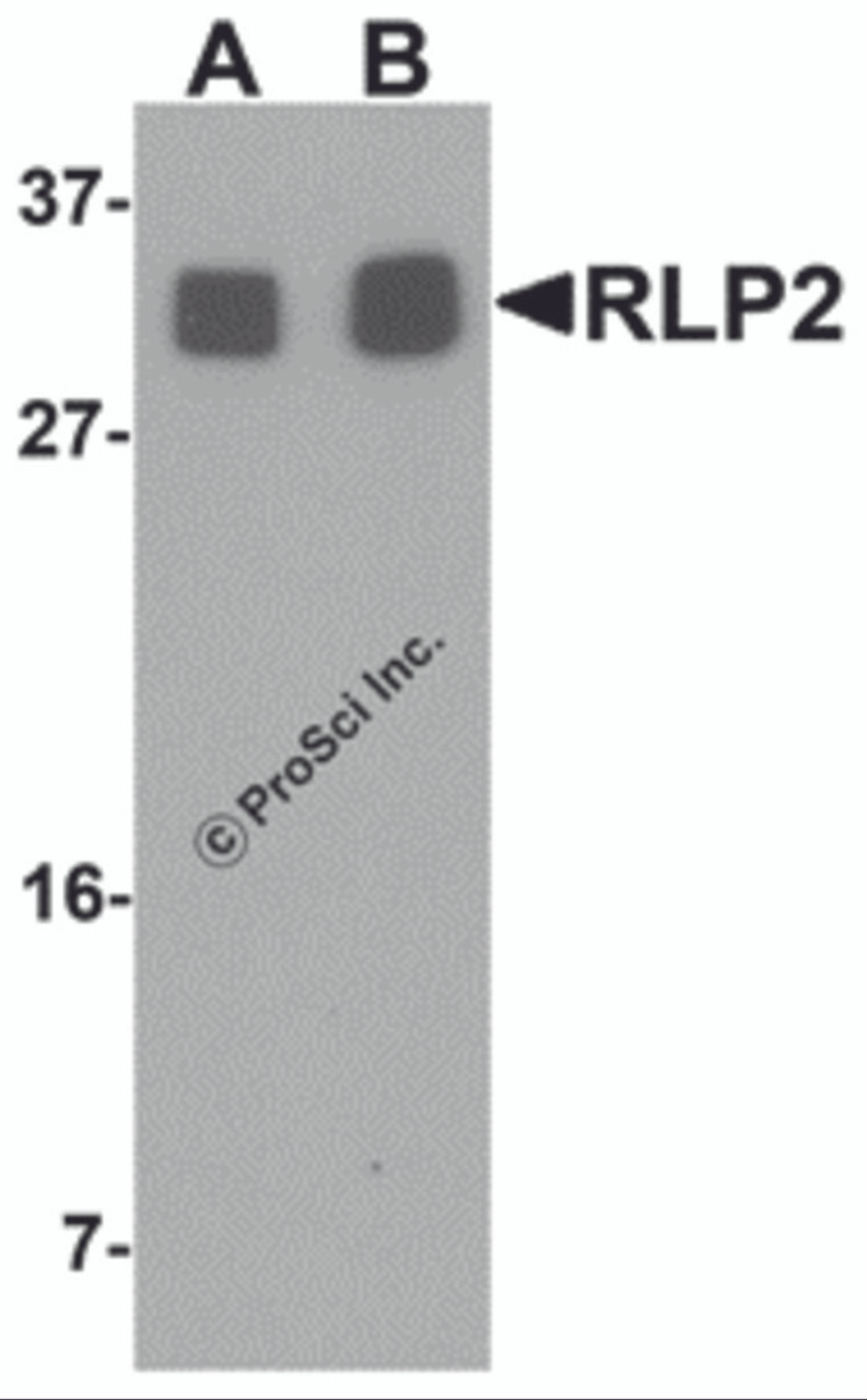 Western blot analysis of RLP2 in A549 cell lysate with RLP2 antibody at (A) 1 and (B) 2 &#956;g/mL.