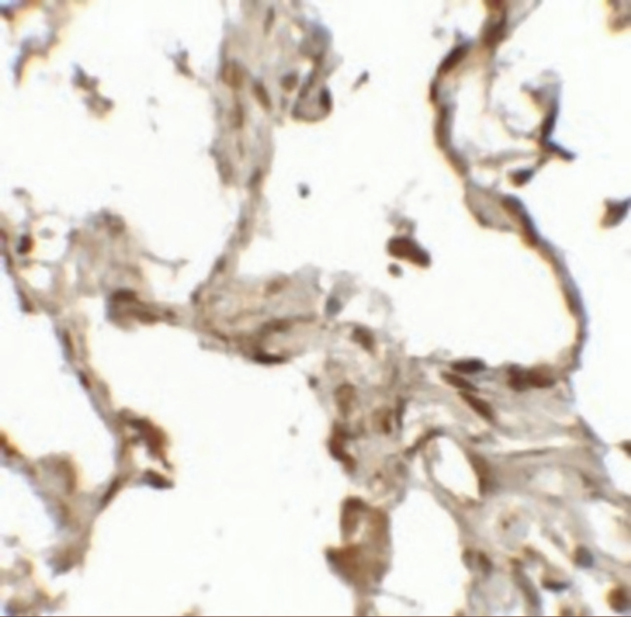 Immunohistochemistry of TFEB (NT) in human lung tissue with TFEB (NT) antibody at 2.5 ug/mL.