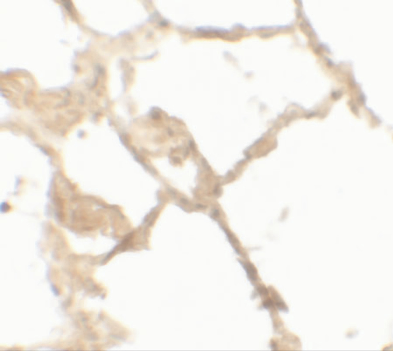 Immunohistochemistry of TFEB in human lung tissue with TFEB antibody at 2.5 &#956;g/mL.